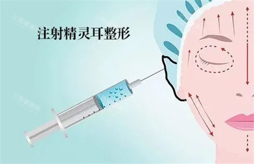 北京精灵耳手术价格大公开！2025全新费用明细+医生技术对比分析！