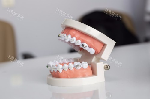 慈溪牙牙乐口腔新版价格表！韩国登腾2680元起、金属托槽矫正6800元起