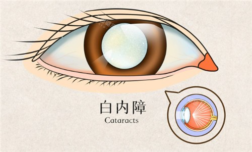 佰视佳眼科靠谱吗？真实患者口碑大揭秘，看完这篇再决定是否选择！