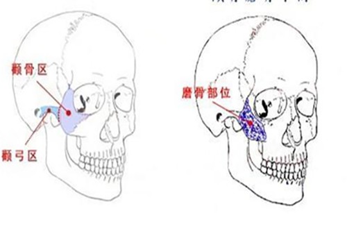 重庆吴一医生磨骨技术怎么样？简介资料查询，是一位磨骨靠谱、技术高、审美在线、自然的医生~