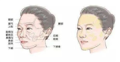 整形医生姚然实力如何？个人简介揭晓，20多年注射经验，揭秘面部年轻化打造秘诀