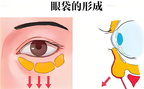 深圳祛眼袋哪家医院比较靠谱？健丽|非凡|弘美|阳光|美莱|鹏程等十家实力机构盘点