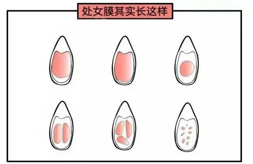昆明韩辰整形私密整形靠谱吗？真实体验分享+医生技术解析，看完这篇你就懂了！