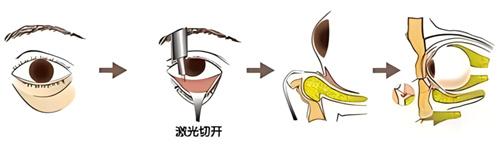想了解南昌佳美美容医院周方宾怎么样？看他在眼部、鼻部等多领域的娴熟技术和强大成就！