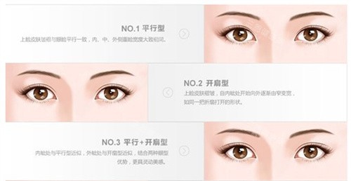 东莞东城爱思特医疗美容门诊部口碑如何？到底好不好？真实评价来参考