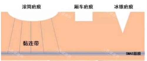 长沙中科皮肤医院是公立还是私立？卫健委认证的正规私立机构，疤痕修复好评超多