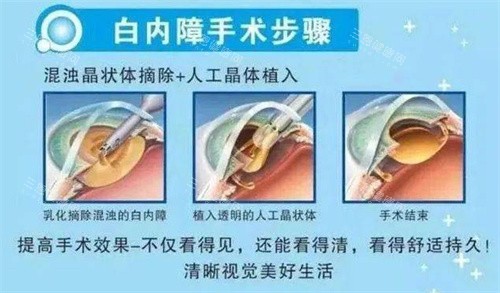 阜阳市人民医院眼科​​怎么挂号，可通过电话预约/网上预约/到院预约等方式挂号！