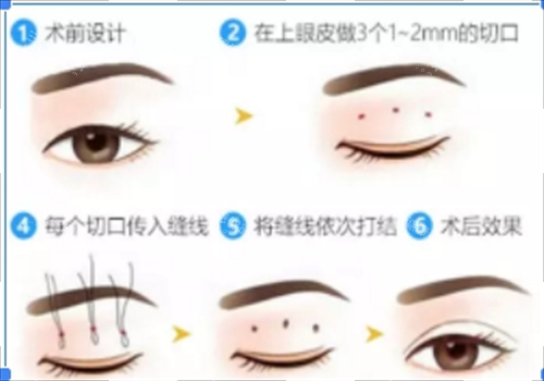 沈阳和平蓝天医疗美容门诊部实力如何？口碑和项目成果来揭秘