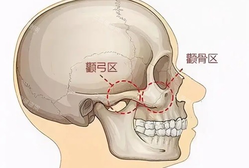 北京王东医生个人资料！将从医生坐诊医院、擅长一针降颧骨/脂肪修复/吸脂、技术优势解析~