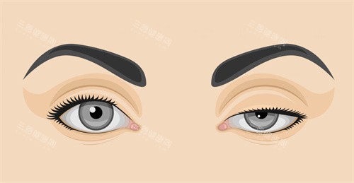 长春双眼皮修复哪家医院做的好？融美/西之米/中妍/奥拉克等10家眼修复热门机构技术实力测评！