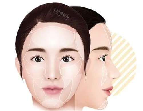 广州馒化脸修复最好的医生是谁啊？齐云香/金洪尧/王世虎/余文林/钟杰光馒化修复技术好且成效满意