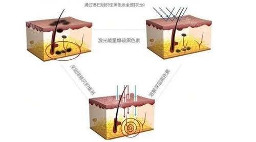 抚州祛斑祛痣医院哪家好,推荐梦婷|薇琳|德尔美客|江医生,祛斑祛脂都擅长!