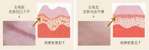 吉安祛斑医院哪家好?强烈推荐韩美|上喜|天姿|天使几家热门机构,激光祛斑技术好!