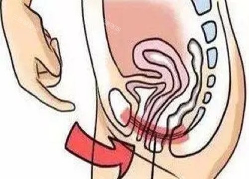 深圳千氧医疗美容女性私密价格表查询~整理了价目表，快来看看不同项目多少钱！