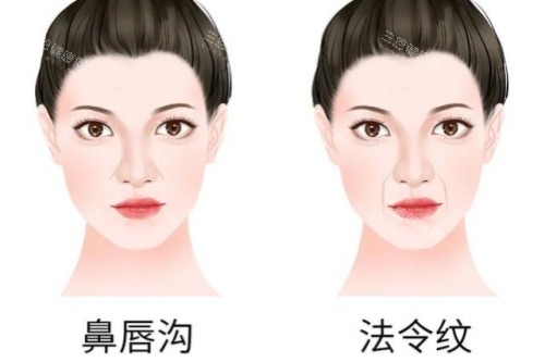 鼻唇沟和法令纹卡通对比图