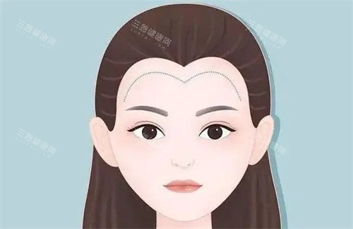 福州靓壹生植发价格表2025版！从询问到术后，这份攻略帮你省下冤枉钱！