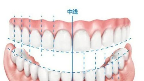 牙齿中线.webp