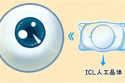 西安市第四医院眼科电话号码是多少？官网预约挂号、到院挂号方式全攻略！