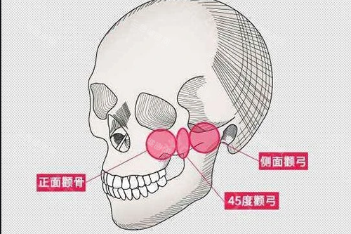 正颌手术口碑哪家比较好？国内5家高评分医院对比，术后自然复原比较快！