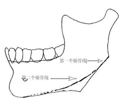 脸型不对称矫正哪里靠谱？国内5家正规机构对比，术后轮廓协调不僵硬！