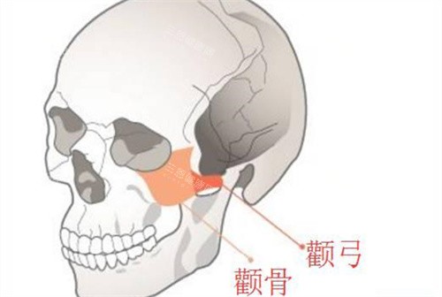 颧骨降低3万够吗？北上广深价格大比拼，原来这些隐藏费用更容易忽略！