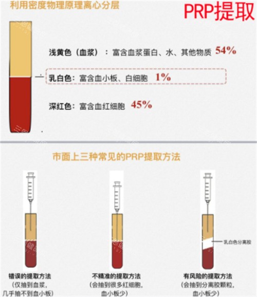 亲身经历：高潮针打完后3点感受与快速改善攻略推荐！