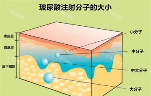 对比测评：铂安润玻尿酸vs艾莉薇传奇，哪款更值选5大维度分析！