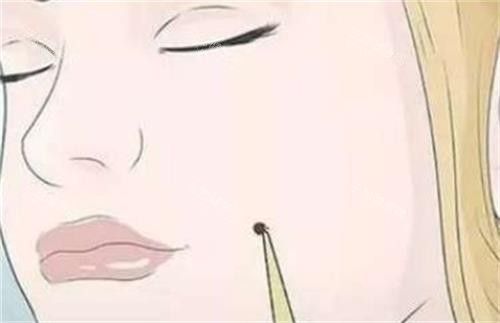 北京长庚医院祛斑亲测：激光项目怎么样？术后护理5要点解析！