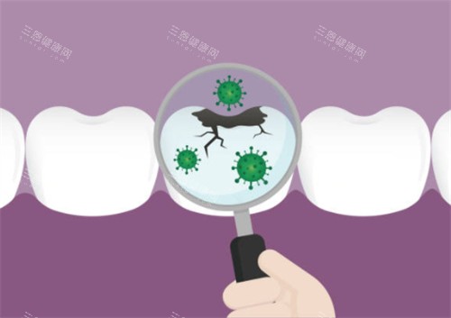 平舆县哪家牙科比较便宜？亚德口腔和牙洁士口腔正规靠谱|医疗标准高|种植牙正畸便宜又好