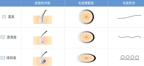 在重庆唐森做植发是什么体验？术后患者自述：这些优点没人提！