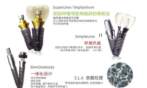 哈尔滨优诺博士口腔不同植体特点图
