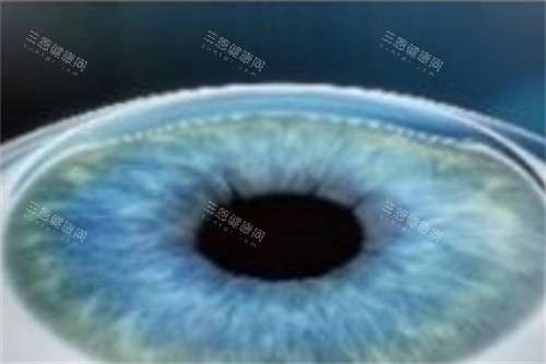 全飞秒手术结束