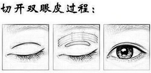北京八大处整形需提前预约吗？提前5天排期，预约挂号方式及流程赶紧收藏