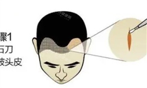 一键速查哪些地方有贞韩毛发研究院?广州/南宁/柳州/桂林/玉林/百色都有,正规植发专科无需远行!