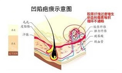 重庆杨东运在哪家医院坐诊？答案是重庆东上整形疤痕修复中心，位于渝北区天山大道（附预约方式）