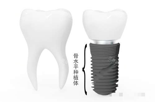 保定口腔治疗2025收费标准：种植牙|牙齿矫正|儿童矫正|补牙|根管治疗费用都能查！