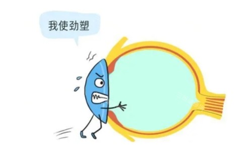 2025成都白内障手术免费政策重磅发布！60岁以上老人速看申请流程，附五家指定医院名单！