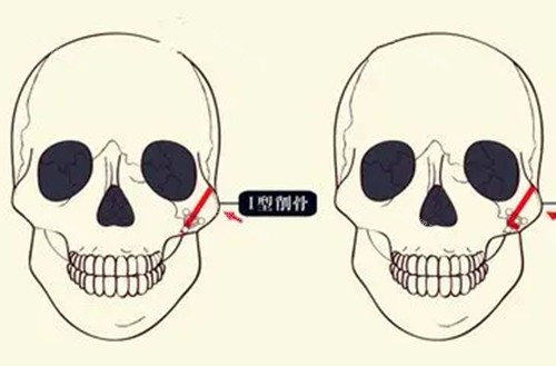 杭州削骨整形综合医院盘点！可靠系数高、价格透明，这几家医生技术真的绝了！
