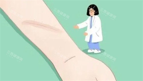 贵阳市第一人民医院整形科能报销吗？从烧伤整形到医疗美容，梳理报销范围与限制，帮你合理消费