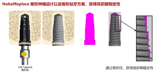 佛山牙科收费价目表2025，种植牙5000元起、牙齿矫正8000元起、拔牙200元起、补牙300元起~
