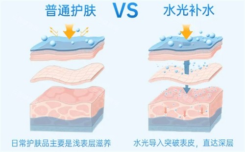 艾维岚上瘾红85mg水光注射28天记录，法令纹变淡、肤色均匀，同事以为我偷偷do脸！