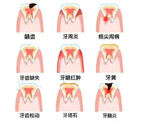 武汉大学口腔医院挂号预约超方便：公众号候补挂号、自助机早7:30放号、电话027-87686110，总有一种方式适合你