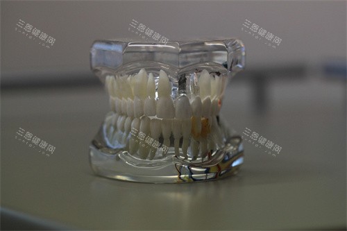 牙齿模型示意图宣传