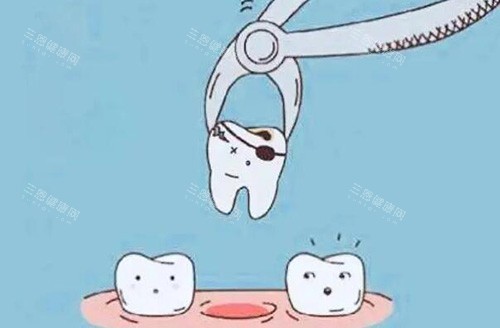东莞拔牙多少钱一颗？2025价格：乳牙拔除120元起、智齿350元起、下颌正位400元起、阻生800元起~