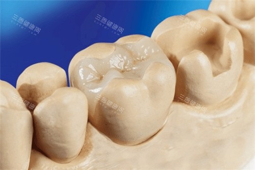 惊！九江优铠口腔价格表曝光，种植牙 2662 起，牙齿矫正 6782 起，速看！