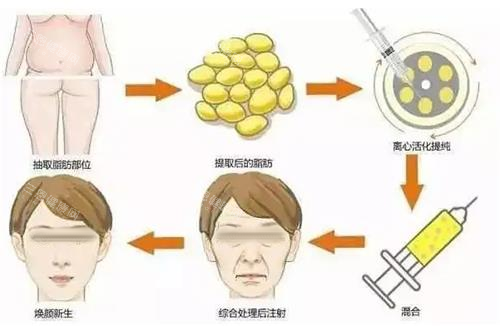面部填充步骤图