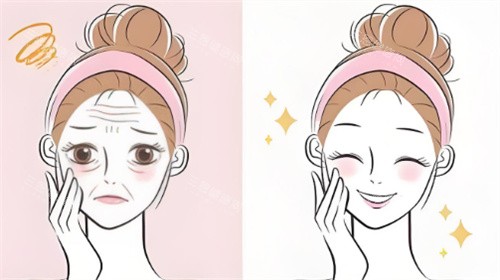 脸部抗衰对比