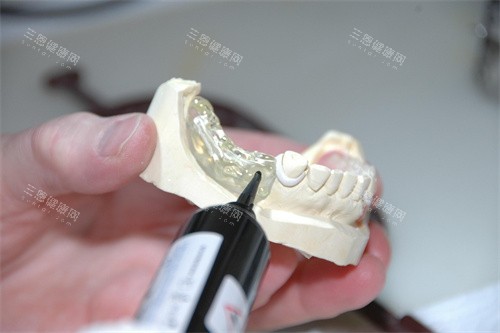 牙齿修复示意图宣传