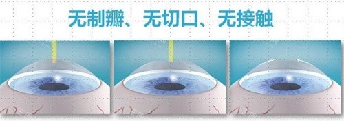 北京同仁医院眼科价格表一览！含同仁开展各项眼科项目收费明细！