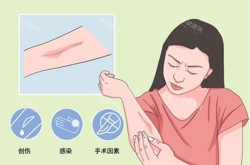 疤痕/胎记患者必看！广州曙光医院正规资质+真实病例大公开！